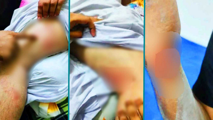 আন্দোলনে নেতৃত্ব দেওয়া চার কুয়েট শিক্ষার্থীর ওপর হামলা