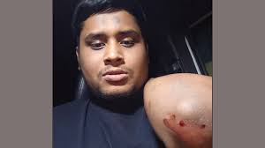 গাজীপুরে হাসনাত আব্দুল্লাহর গাড়িতে হামলা