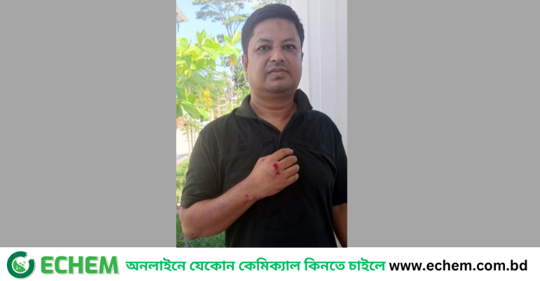 ঝালকাঠিতে সাংবাদিক কে এম সবুজের ওপর হামলা