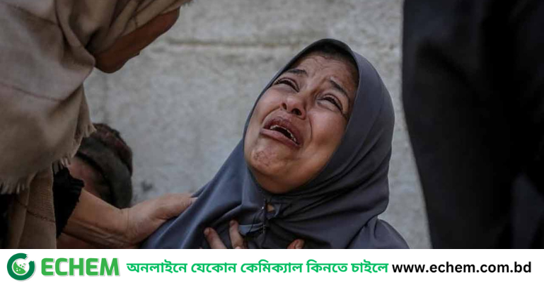 গাজায় নিহত ৭২, ক্ষুধা-অনাহারে শিশুসহ মৃত্যু আরও ৭ জনের