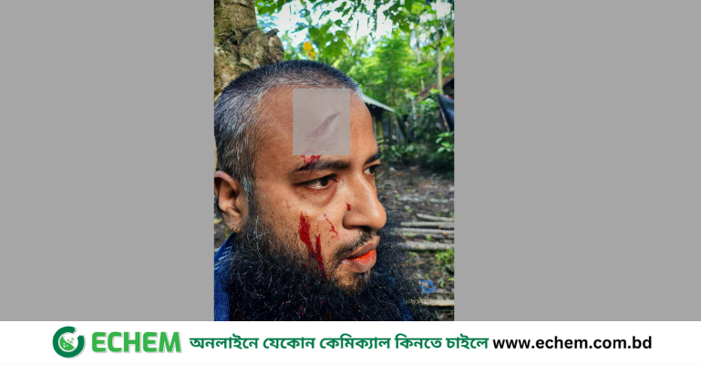 নলছিটিতে জমি বিরোধে মাদরাসা শিক্ষক ও প্রবাসীকে কুপিয়ে জখম যুবলীগ নেতার