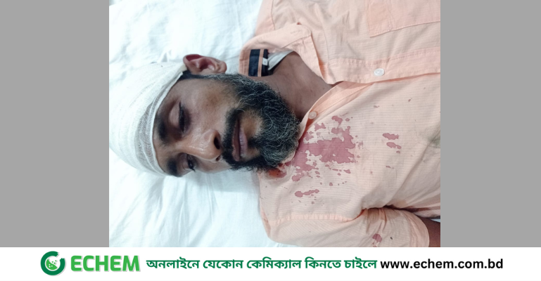 ফরিদপুরে ফেসবুকে স্ট্যাটাস দেওয়ায়  কৃষকদল নেতার উপর হামলা