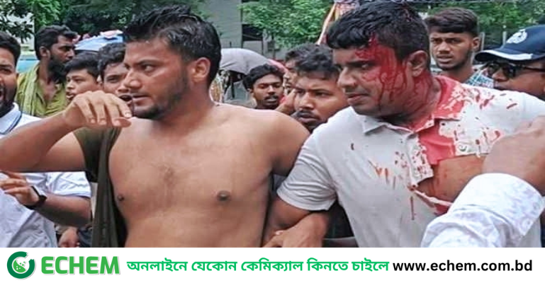 ফরিদপুরে স্বেচ্ছায় জুলাই গেজেট থেকে নাম প্রত্যাহারের আবেদন এক আহত জুলাই যোদ্ধার