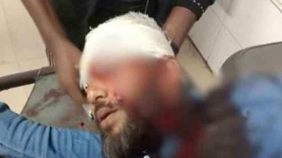 এবার খুলনায় এনসিপি নেতাকে প্রকাশ্যে গুলি