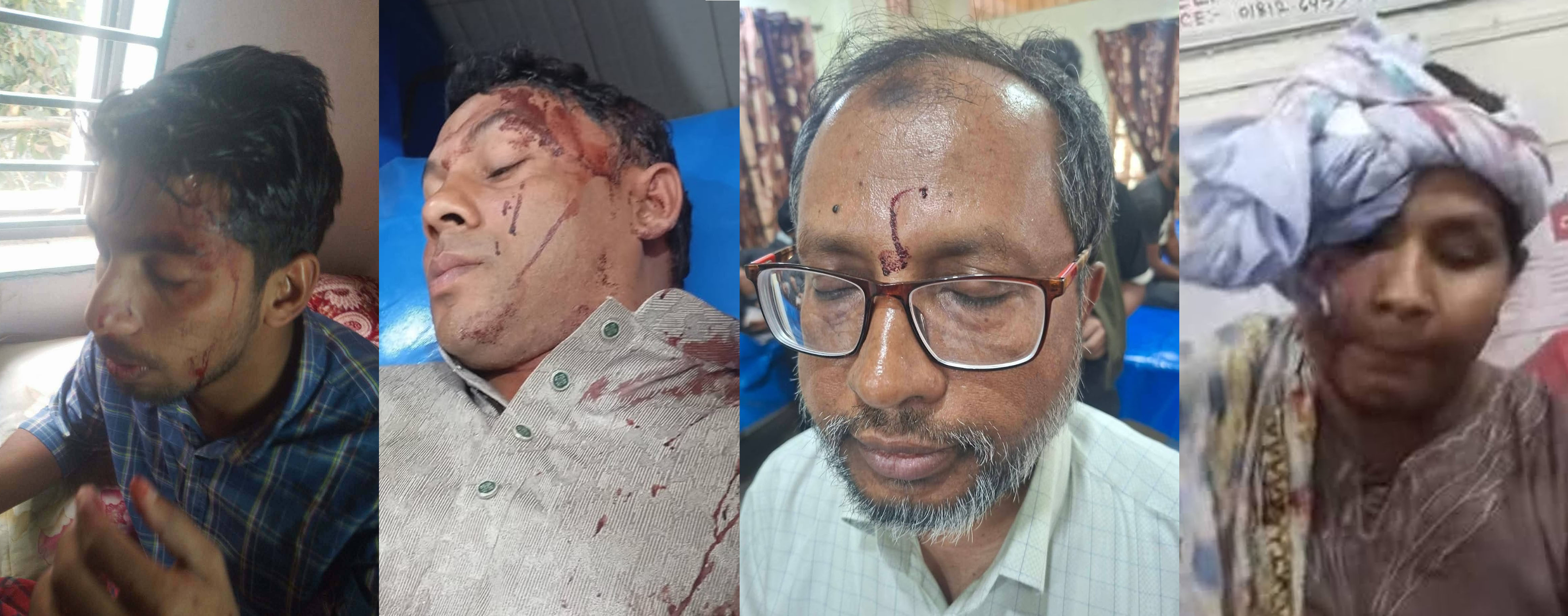 চৌদ্দগ্রামে বাক বিতন্ডার জেরে জামায়াত-বিএনপির সংঘর্ষে আহত ৮