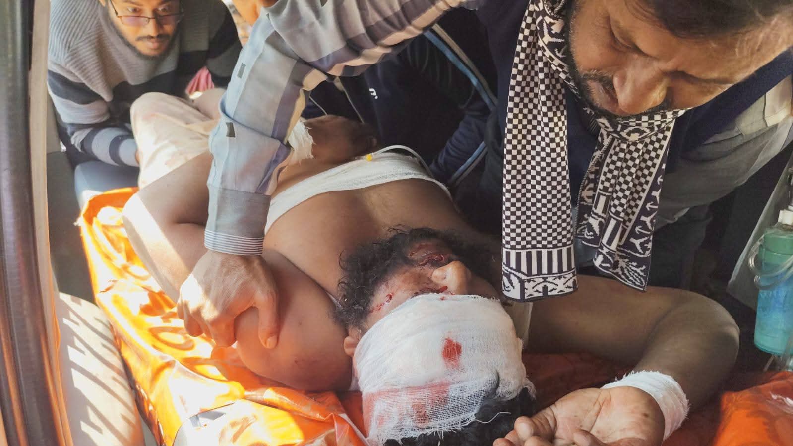 বড়াইগ্রামে নির্বাচন পরবর্তী সহিংসতা: জামায়াত-বিএনপি সংঘর্ষে ইউনিয়ন জামায়াতের আমীর সহ ৭জন আহত