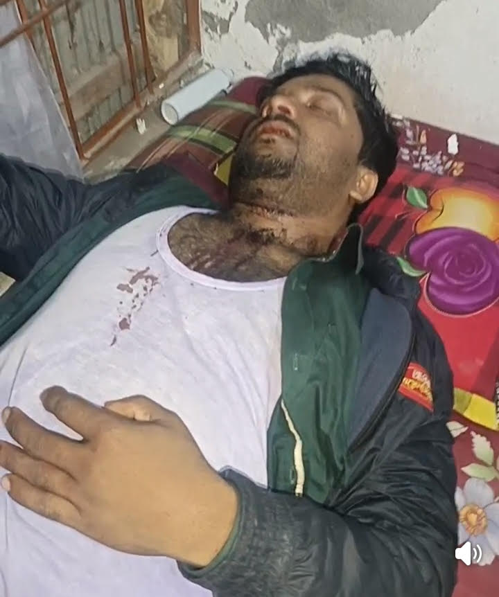 সাতক্ষীরার কালিগঞ্জে পরাজিত দুই প্রার্থীর সমর্থকদের মধ্যে সংঘষে ৫জন আহত