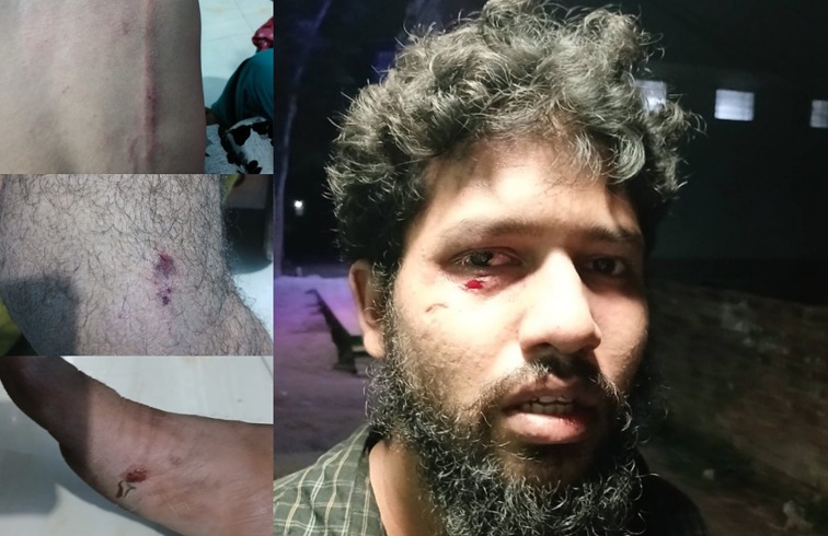 কুয়েট শিক্ষার্থীর উপর যুবদল নেতাকর্মীদের হামলা